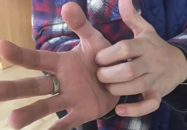 ¿Cuál es la mano que se dice que pica cuando vas a recibir dinero?